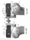 Fig. 45 - Implants with transition surfaces and related processes