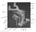 Fig. 01 - Alignment guides for use in computer assisted orthopedic surgery to prepare a bone element for an implant