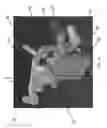 Fig. 12 - Alignment guides for use in computer assisted orthopedic surgery to prepare a bone element for an implant