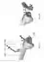 Fig. 15 - Alignment guides for use in computer assisted orthopedic surgery to prepare a bone element for an implant