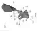 Fig. 18 - Alignment guides for use in computer assisted orthopedic surgery to prepare a bone element for an implant