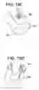 Fig. 23 - Percutaneous access devices and bone anchor assemblies