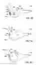 Fig. 17 - Placing sutures