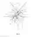 Fig. 05 - Facet Joint Implant and Related Methods