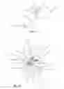 Fig. 11 - Facet Joint Implant and Related Methods