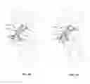 Fig. 36 - Facet Joint Implant and Related Methods