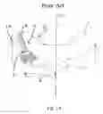 Fig. 02 - Method and system for trans-lamina spinal fixation