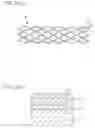 Fig. 02 - Stent and Method For Fabricating the Same