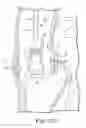 Fig. 28 - Surgical delivery device and method of use