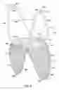 Fig. 07 - Venous valve apparatus, system, and method