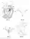 Fig. 07 - METHODS, SYSTEMS AND DEVICES FOR CARDIAC VALVE REPAIR