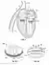 Fig. 08 - METHODS, SYSTEMS AND DEVICES FOR CARDIAC VALVE REPAIR