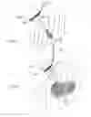 Fig. 43 - METHODS, SYSTEMS AND DEVICES FOR CARDIAC VALVE REPAIR