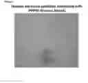 Fig. 02 - Tissue Engineered Meniscus Repair Composition