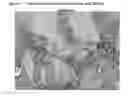 Fig. 04 - Tissue Engineered Meniscus Repair Composition
