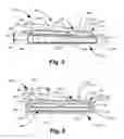 Fig. 04 - Endplate for an intervertebral prosthesis and prosthesis incorporating the same