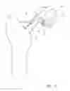 Fig. 06 - Instrument for use in a joint replacement procedure