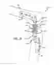 Fig. 03 - Adjustable absorber designs for implantable device