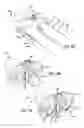 Fig. 08 - Adjustable absorber designs for implantable device