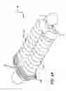 Fig. 11 - Adjustable absorber designs for implantable device