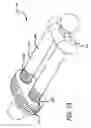 Fig. 13 - Adjustable absorber designs for implantable device