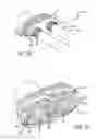 Fig. 14 - Adjustable absorber designs for implantable device