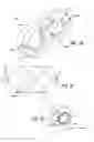 Fig. 18 - Adjustable absorber designs for implantable device