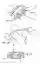 Fig. 22 - Adjustable absorber designs for implantable device