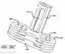 Fig. 52 - Adjustable absorber designs for implantable device
