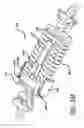 Fig. 56 - Adjustable absorber designs for implantable device