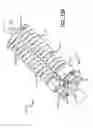 Fig. 61 - Adjustable absorber designs for implantable device