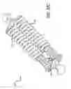 Fig. 62 - Adjustable absorber designs for implantable device