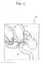Fig. 02 - Method of producing flexible vessel model for simulating surgical operation