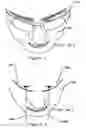Fig. 02 - Swimming goggles