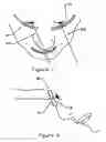 Fig. 05 - Swimming goggles