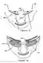 Fig. 06 - Swimming goggles