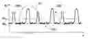 Fig. 01 - Characterization of fancy yarn
