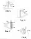 Fig. 06 - Low noise wind shield system