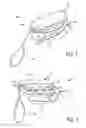 Fig. 02 - Hand-mountable noise maker