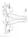 Fig. 02 - MINIMALLY INVASIVE DELIVERY DEVICES AND METHODS