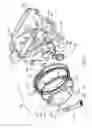Fig. 08 - MINIMALLY INVASIVE DELIVERY DEVICES AND METHODS