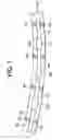 Fig. 02 - FLOW CONTROL USING A TORTUOUS PATH