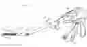 Fig. 01 - Surgical instrument having recording capabilities