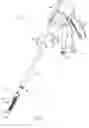 Fig. 02 - Surgical instrument having recording capabilities