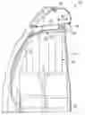 Fig. 01 - Device for delimiting a crew rest compartment and method for implementing such a device