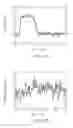Fig. 11 - Localization of a radioactive source within a body of a subject