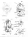 Fig. 06 - System of Controlling Fluid Flow