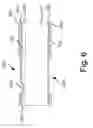 Fig. 07 - Chip for Reliable Stacking on another Chip
