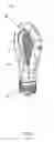 Fig. 05 - Light emitting diode lamp structure