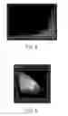 Fig. 06 - LIGHT EMITTING DIODE LIGHT SOURCE DEVICE WITH COLOR TEMPERATURE ADJUSTMENT CAPABILITY